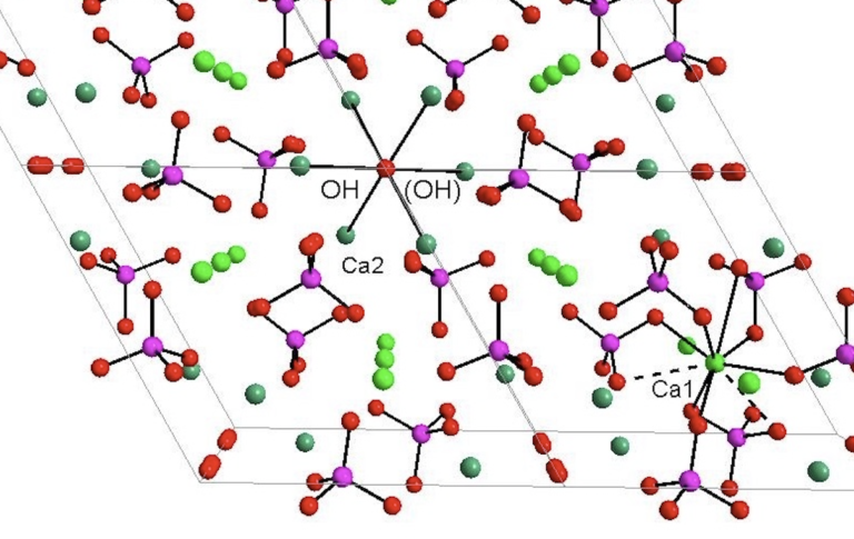 Idrossiapatite nanocristallina nella chirurgia rigenerativa parodontale