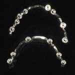 Protesi implantari full-arch: algoritmo decisionale per una scelta razionale del framework metallico e dei materiali di rivestimento estetico