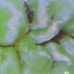 Il supporto della fluorescenza alla diagnosi visiva della lesione cariosa