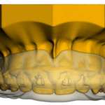 Odontoiatria e sport oggi