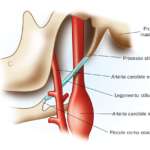 Sindrome di Eagle: una patologia di difficile interpretazione