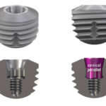 Impianti ultra corti, una soluzione innovativa per un trattamento mininvasivo