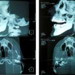 Disfunzioni gnatologiche, ortodontiche e cranio-cervico-mandibolari: evoluzione dell’approccio strumentale