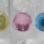 La tecnica Socket-Shield nella prevenzione del riassorbimento osseo post-estrattivo