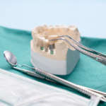 Odontotecnici operatori sanitari: Anelli chiarisce le dichiarazioni nell’articolo Ansa Federodontotecnica