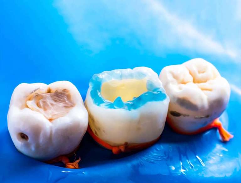 Nuovi materiali da adesione: caratteristiche e prospettive