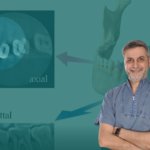 Il ruolo della CBCT nella qualità del trattamento endodontico