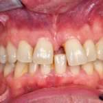 Collaborazione “orto – perio”: una sinergia per incrementare funzione ed estetica