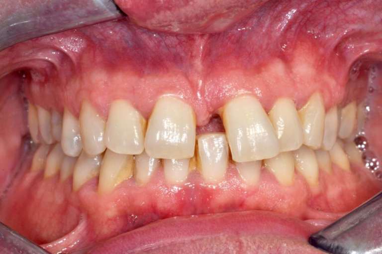 Collaborazione “orto – perio”:  una sinergia per incrementare funzione ed estetica