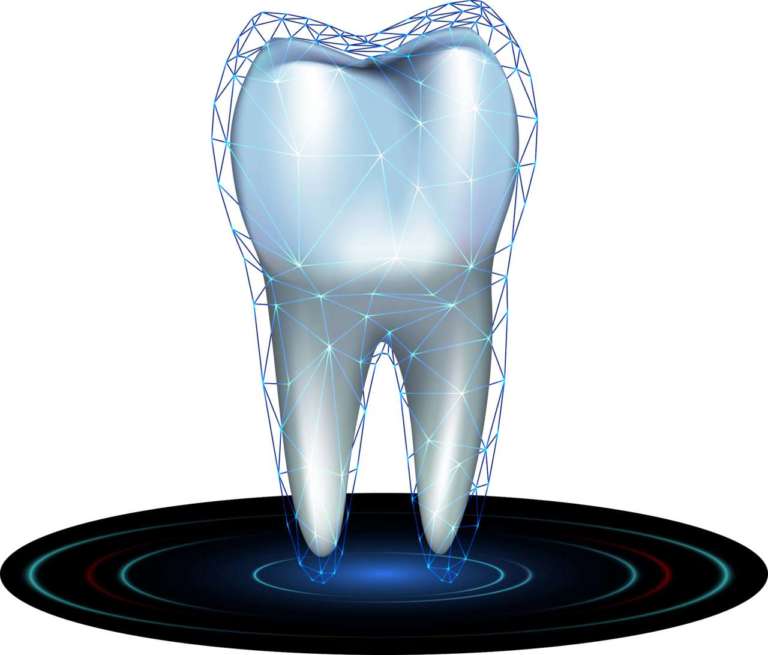 Lo sbiancamento dei denti devitalizzati