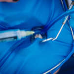 Terapia endodontica: i principali errori in fase di apertura di camera pulpare