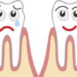 Il trattamento parodontale non chirurgico con una marcia in più