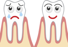 Il trattamento parodontale non chirurgico con una marcia in più