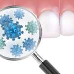 Malattia parodontale: quanto sono utili le terapie antibiotiche?