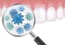 Malattia parodontale: quanto sono utili le terapie antibiotiche?