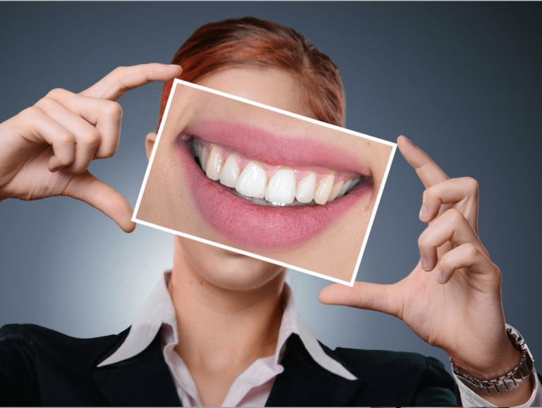 Il trattamento All-on-4® per la riabilitazione della mandibola completamente edentula