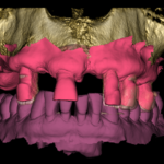 Virtualizzazione e futuro delle cure dentali