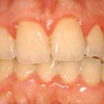 L’innovativa linea Curaspet ADS I DNA Trattamento Astringente riduce in modo mirato il sanguinamento gengivale, fin dal primo utilizzo