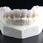 Zirconia e titanio: proprietà antimicrobiche allo studio