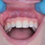 Il microbioma orale: fattore diagnostico e prognostico del carcinoma orale