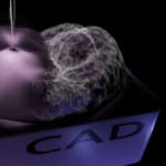 Materiali per CAD/CAM: evoluzione e performance