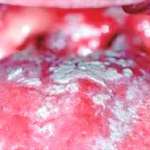 Nuovo corso FAD: la diagnosi delle lesioni del cavo orale