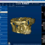 Gestione immagini in odontoiatria: come farlo al meglio e in linea con la certificazione MDR