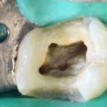 A che ingrandimento lavori? la scelta indirizza il modo di vivere la professione