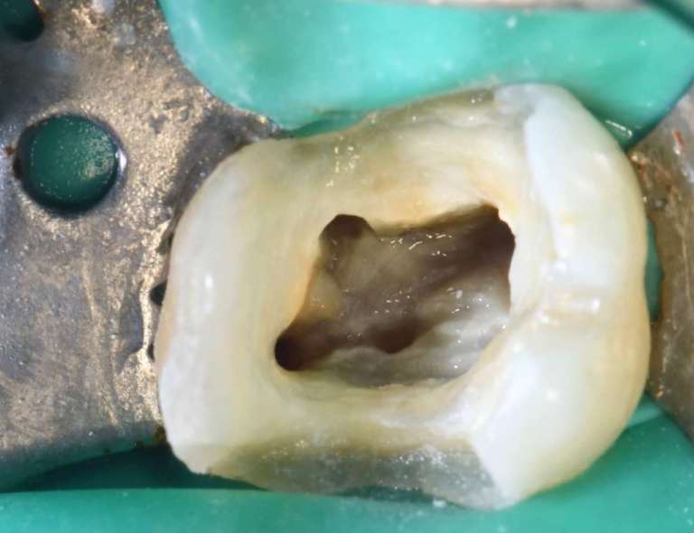 A che ingrandimento lavori? la scelta indirizza il modo di vivere la professione