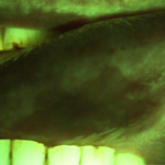 Goccles: quando un paio di occhiali può fare la differenza. Un dispositivo medico per lo screening delle lesioni del cavo orale