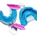 Impronta digitale e analogica: un confronto possibile, ma ancora per poco