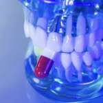 Dolore acuto post-estrazione, i farmaci più efficaci per combatterlo