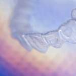 Effetti dei trattamenti ortodontici: cosa dice la letteratura