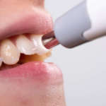 VITA Easyshade LITE: la scala colori in un clic