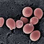 Candida albicans, le nanoparticelle d’argento potrebbero combatterla