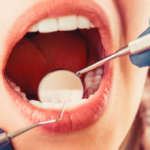 Prevenzione delle patologie orali: l’importanza di un team preparato