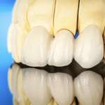 Corona dentale, quando a progettarla è l’intelligenza artificiale