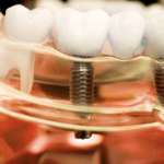 Matrice di collagene xenogenico, come e dove impiegarla