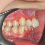 La cura dei bambini con disturbo dello spettro autistico: una challenge per l’odontoiatra pediatrico spettro autistico odontoiatra