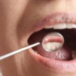 Parodontite grave e variazioni volumetriche dei tessuti molli