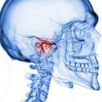 Disturbi temporomandibolari, quanto ne soffrono bambini e adolescenti