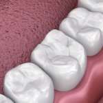 Adesivo universale sperimentale, uno studio sugli effetti della viscosità