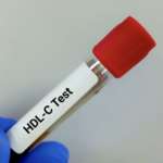 Colesterolo HDL correlato a edentulismo e declino cognitivo