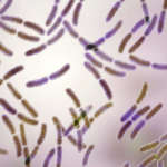 Effetto adiuvante dei probiotici nel trattamento della malattia parodontale e perimplantare