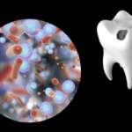 Selenomonas sputigena è tra le possibili cause della carie