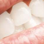 Cemento traslucido, per l’estetica è da preferire a quelli opachi