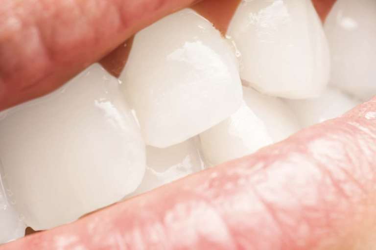 Cemento traslucido, per l’estetica è da preferire a quelli opachi