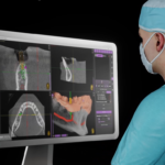 Diagnosi e pianificazione del trattamento implantare con chirurgia guidata: i vantaggi per clinico e pazienti