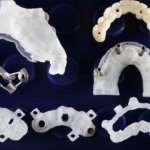 Impianti zigomatici, chiarimenti su alcuni principi biomeccanici