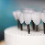 Uno studio sul comportamento meccanico della zirconia